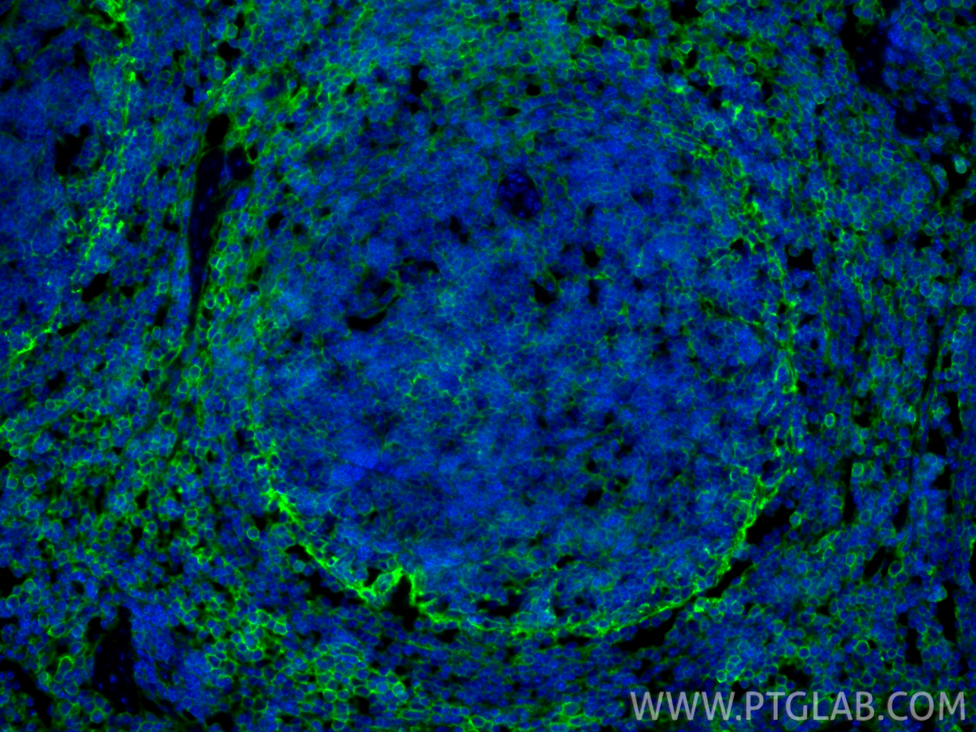 IF Staining of mouse spleen using 85163-5-RR IF Staining of mouse spleen using 85163-5-RR