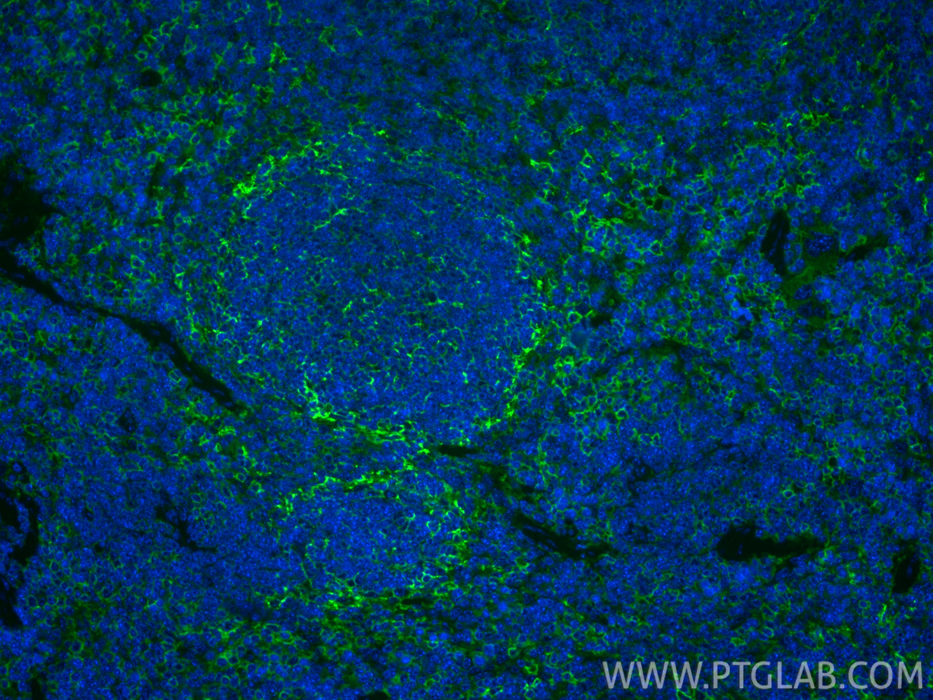 IF Staining of mouse spleen using 85163-5-RR IF Staining of mouse spleen using 85163-5-RR
