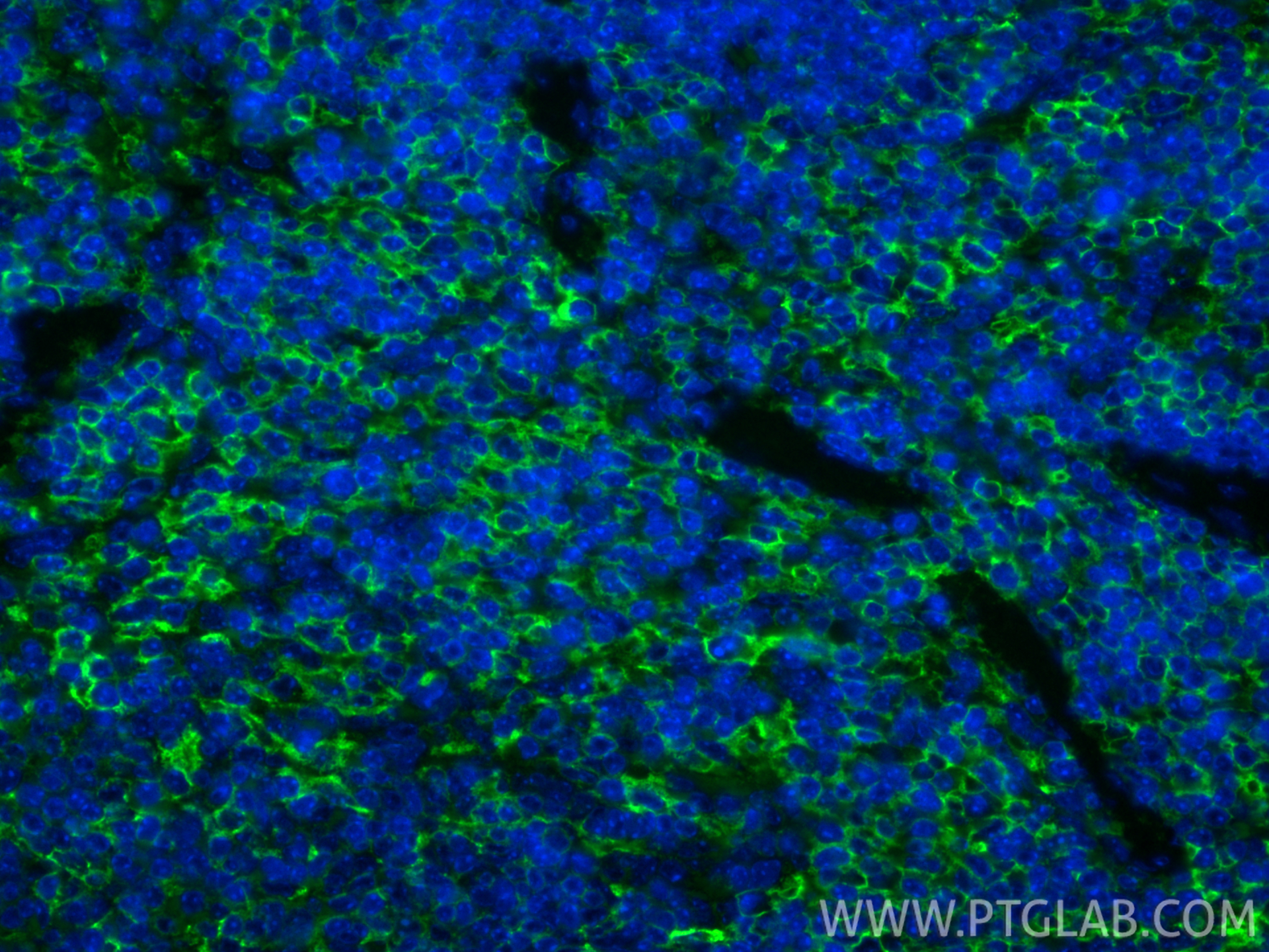 IF Staining of mouse spleen using 85163-5-RR (same clone as 85163-5-PBS)