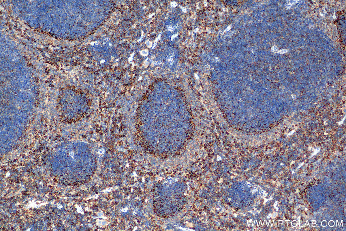 IHC staining of mouse spleen using 85163-5-RR