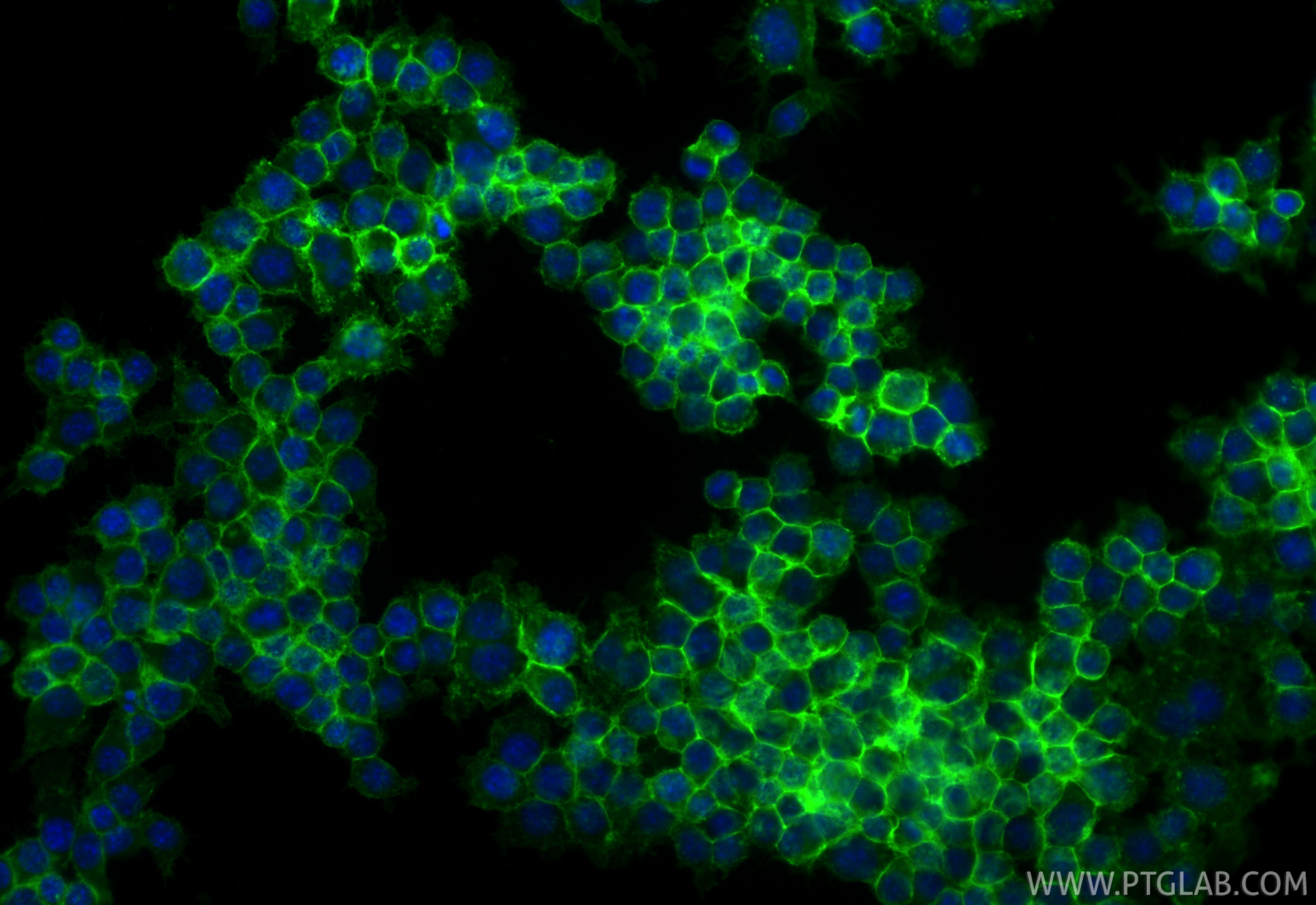 Immunofluorescent analysis of (4% PFA) fixed RAW 264.7 cells using CoraLite® Plus 488 CD44 antibody (CL488-85163-5, Clone: 242666C11) at dilution of 1:200. IF Staining of RAW 264.7 using CL488-85163-5