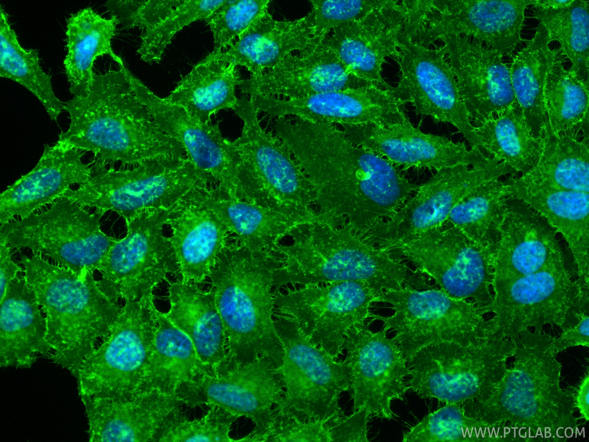 IF Staining of HeLa using RMX00065