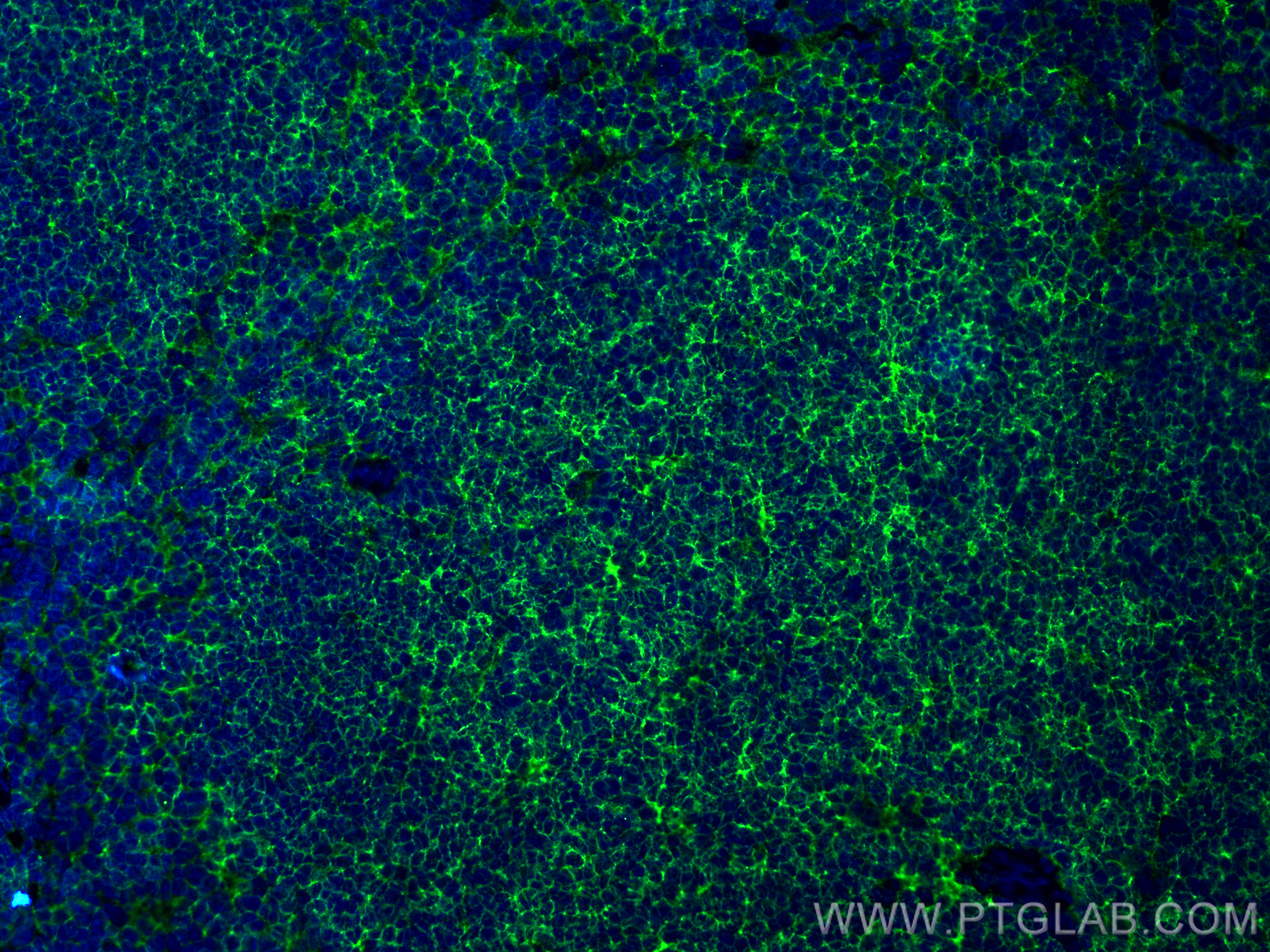 IF Staining of mouse spleen using 84637-1-RR