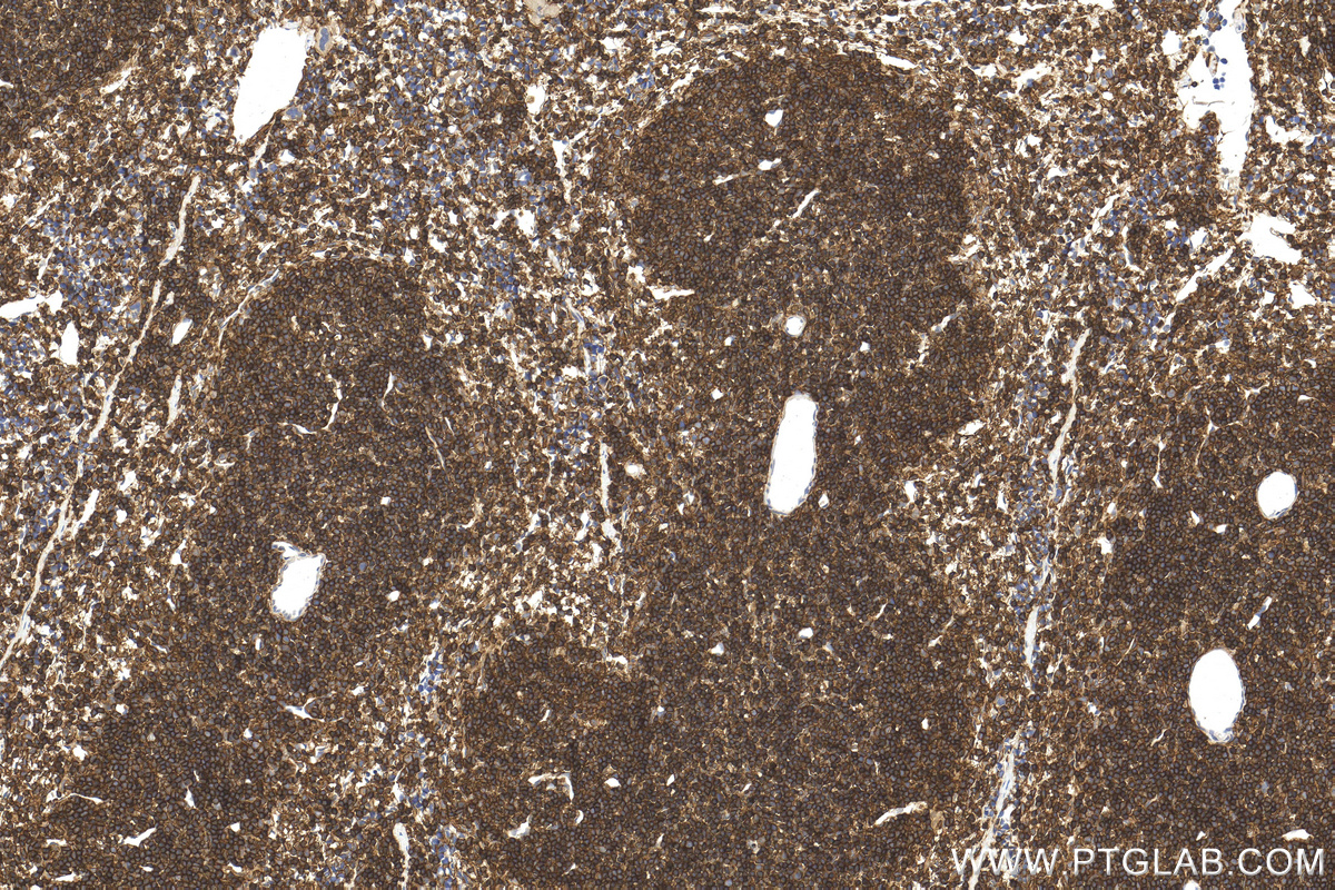 IHC staining of mouse spleen using 31243-1-AP
