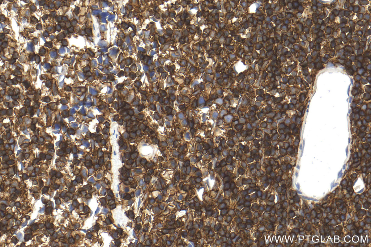 IHC staining of mouse spleen using 31243-1-AP