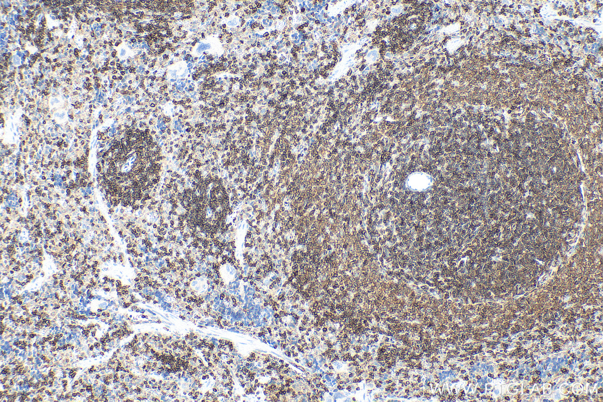 IHC staining of rat spleen using 33651-1-AP IHC staining of rat spleen using 33651-1-AP