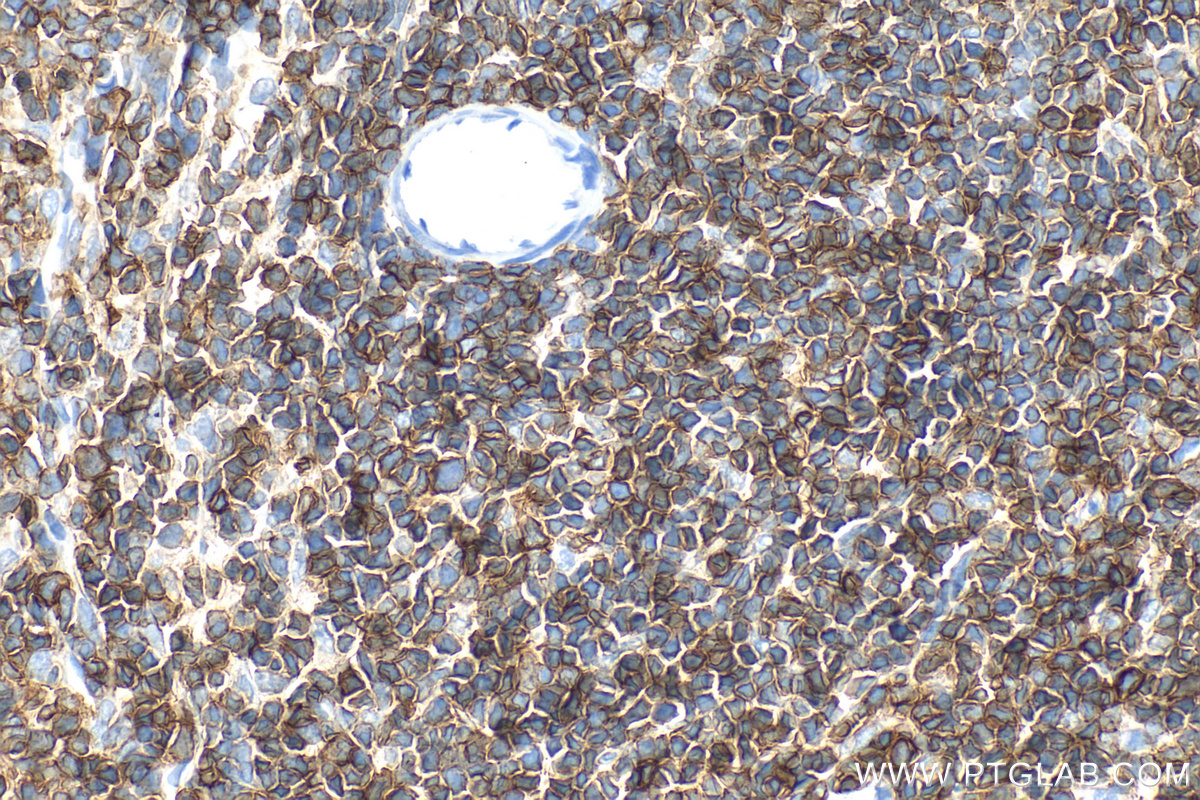 IHC staining of rat spleen using 33651-1-AP IHC staining of rat spleen using 33651-1-AP
