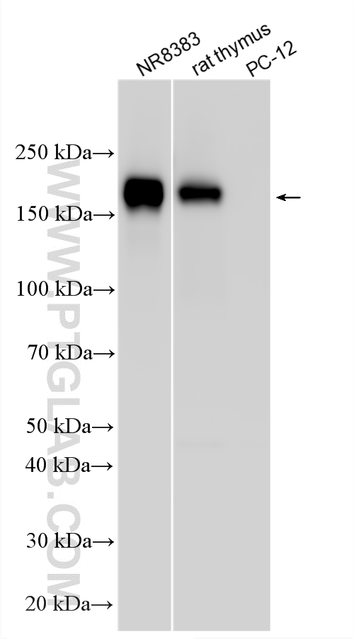 WB analysis using 33651-1-AP WB analysis using 33651-1-AP
