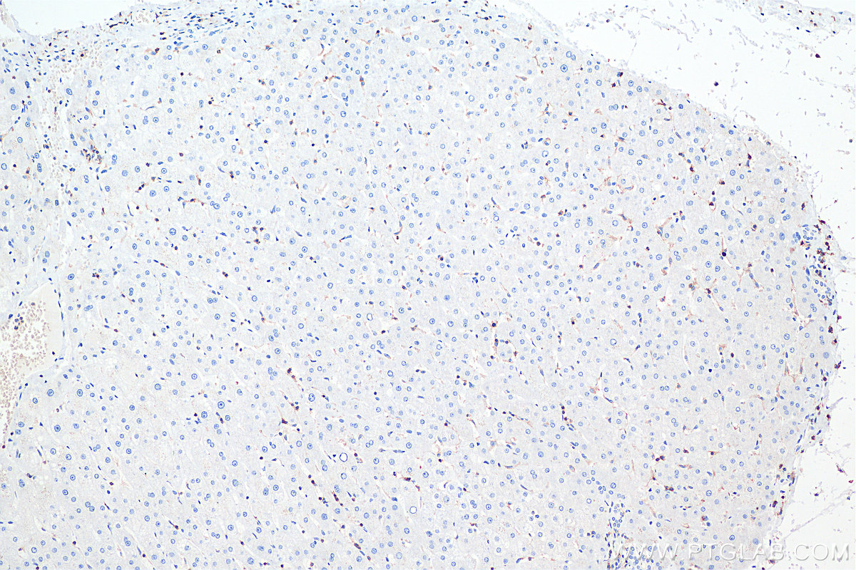 IHC staining of human liver using 60287-1-Ig