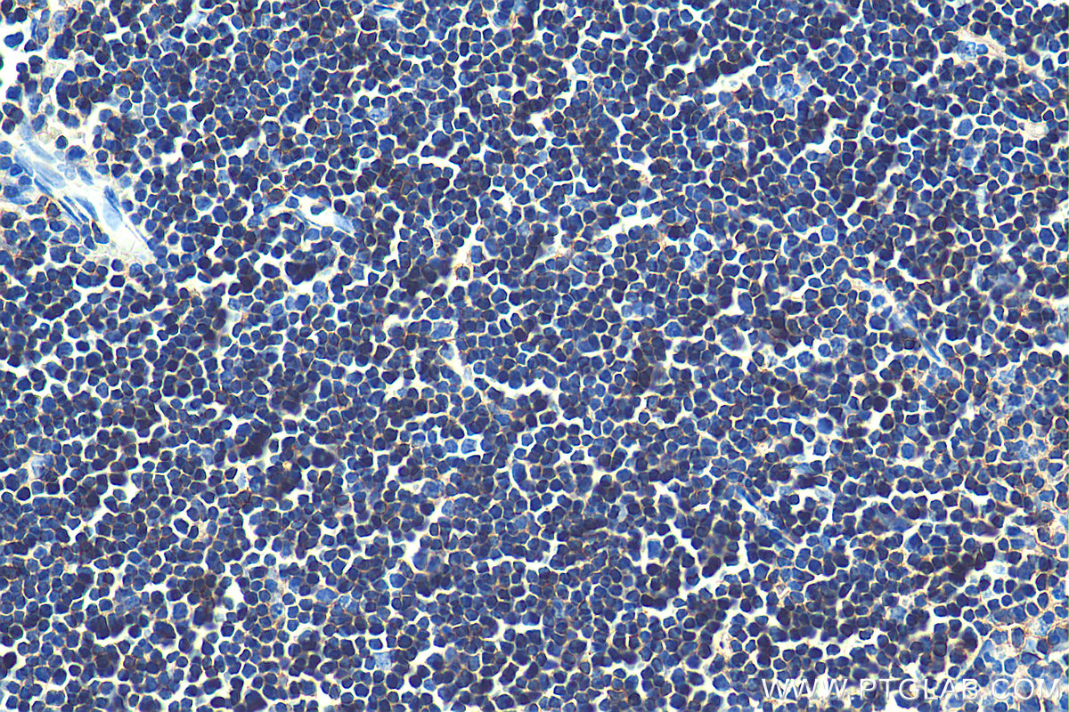 IHC staining of rat thymus using 60287-1-Ig