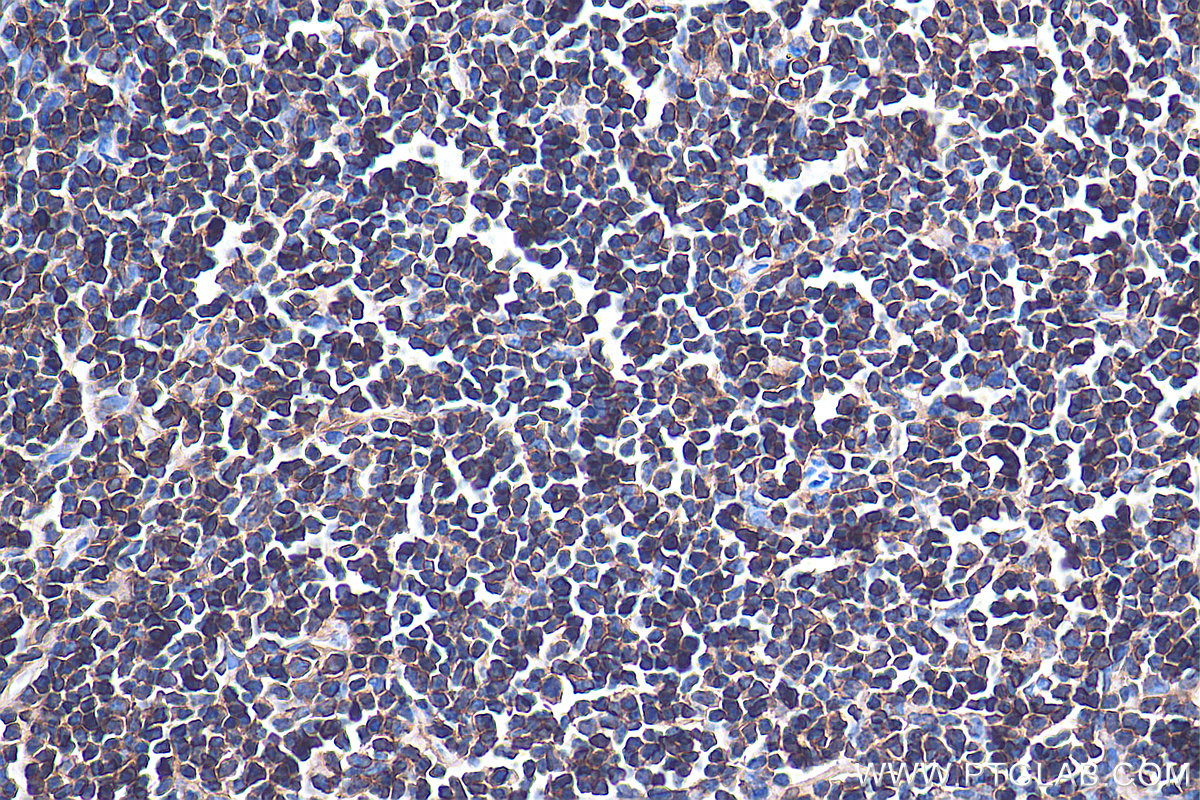 IHC staining of mouse spleen using 60287-1-Ig