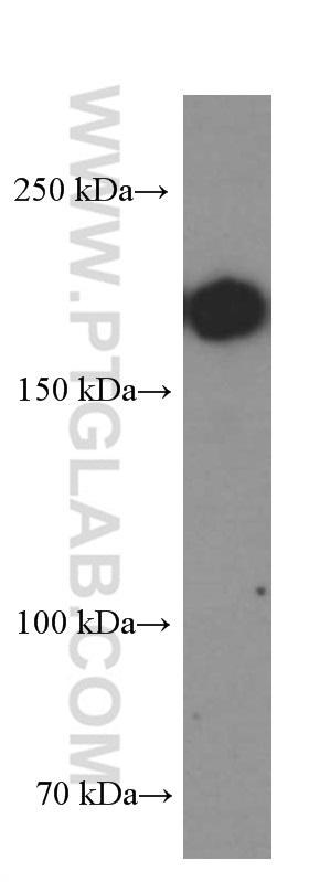 WB analysis of pig spleen using 60287-1-Ig (same clone as 60287-1-PBS)