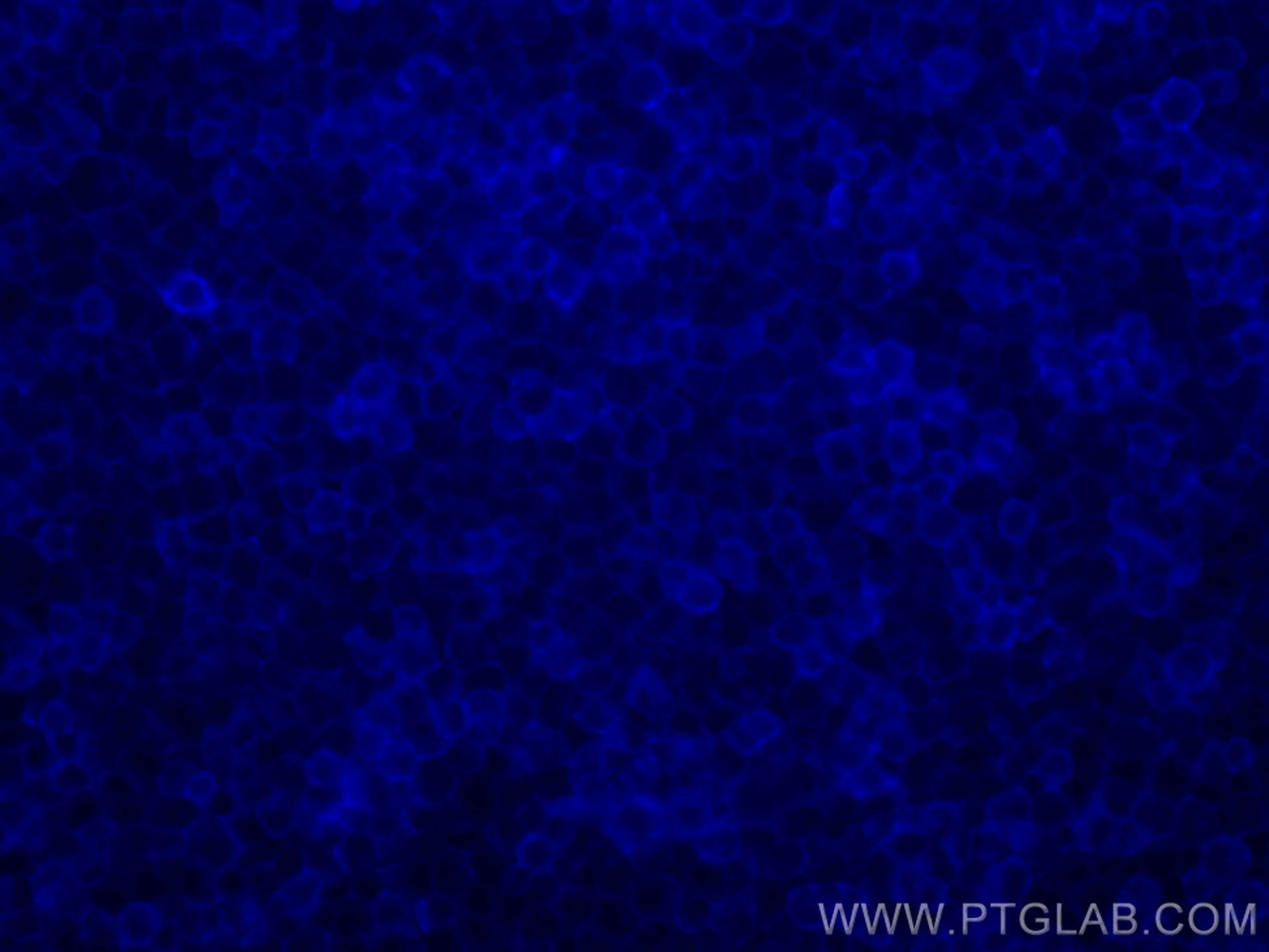 IF Staining of Jurkat using CL405-FcA98117