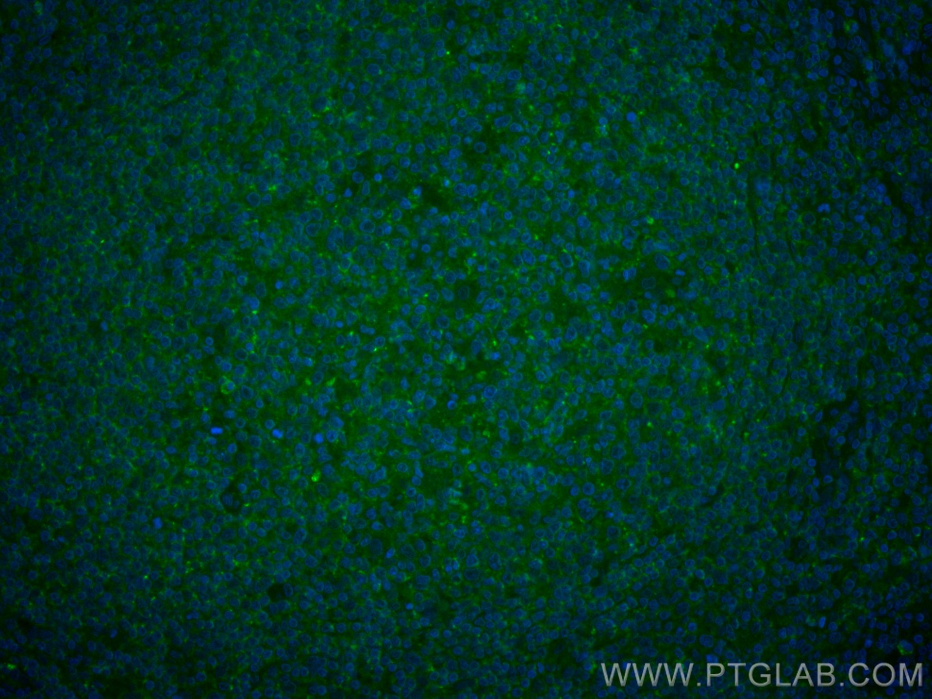 IF Staining of human tonsillitis using CL488-60287