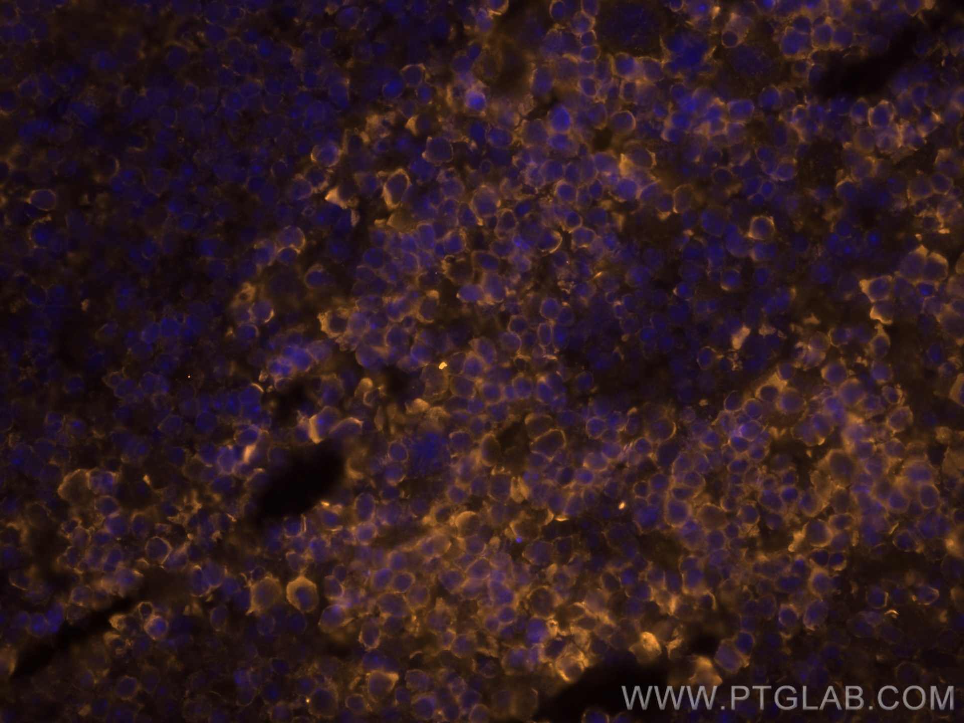 IF Staining of mouse spleen using CL555-60287