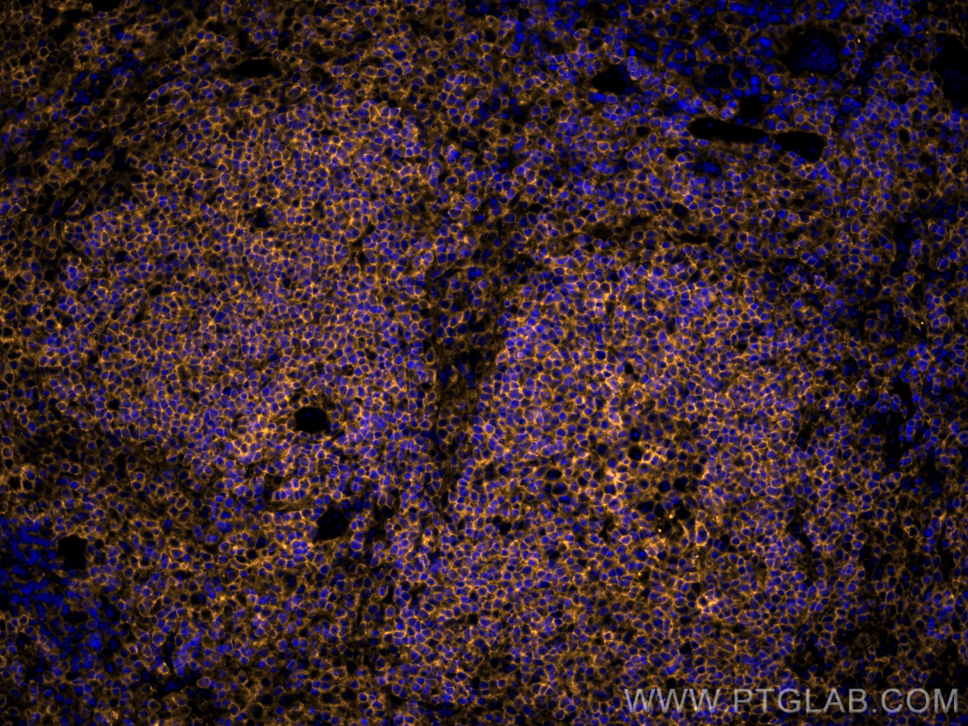 IF Staining of mouse spleen using CL555-80297