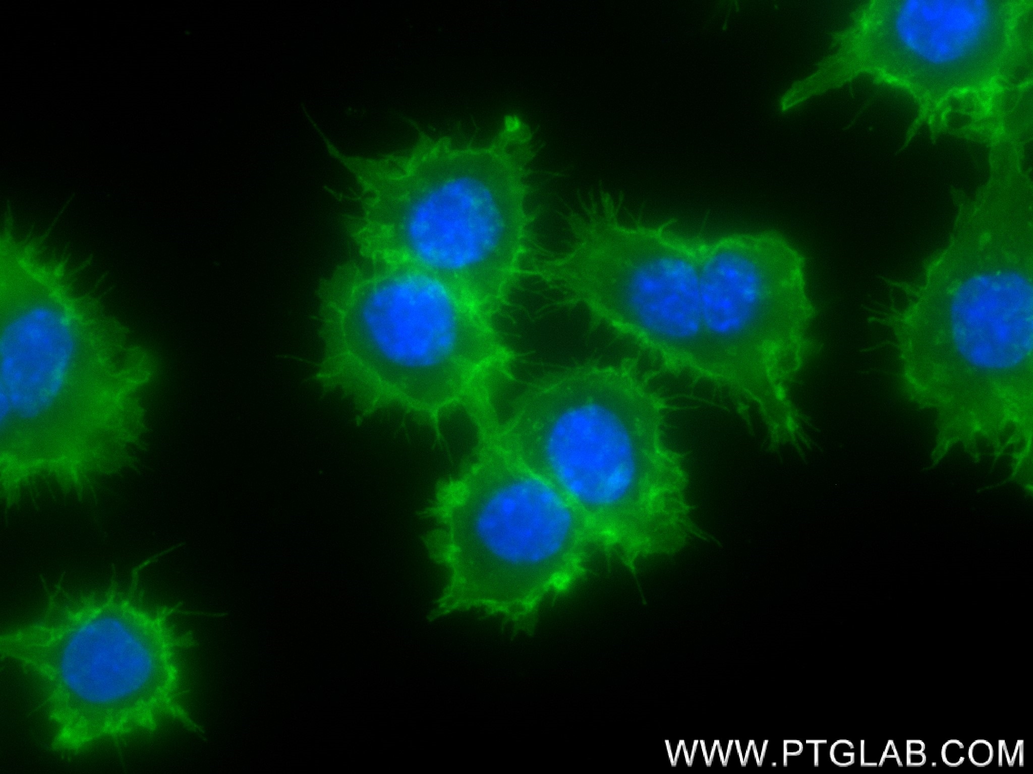 IF Staining of RAW 264.7 using 83396-12-RR