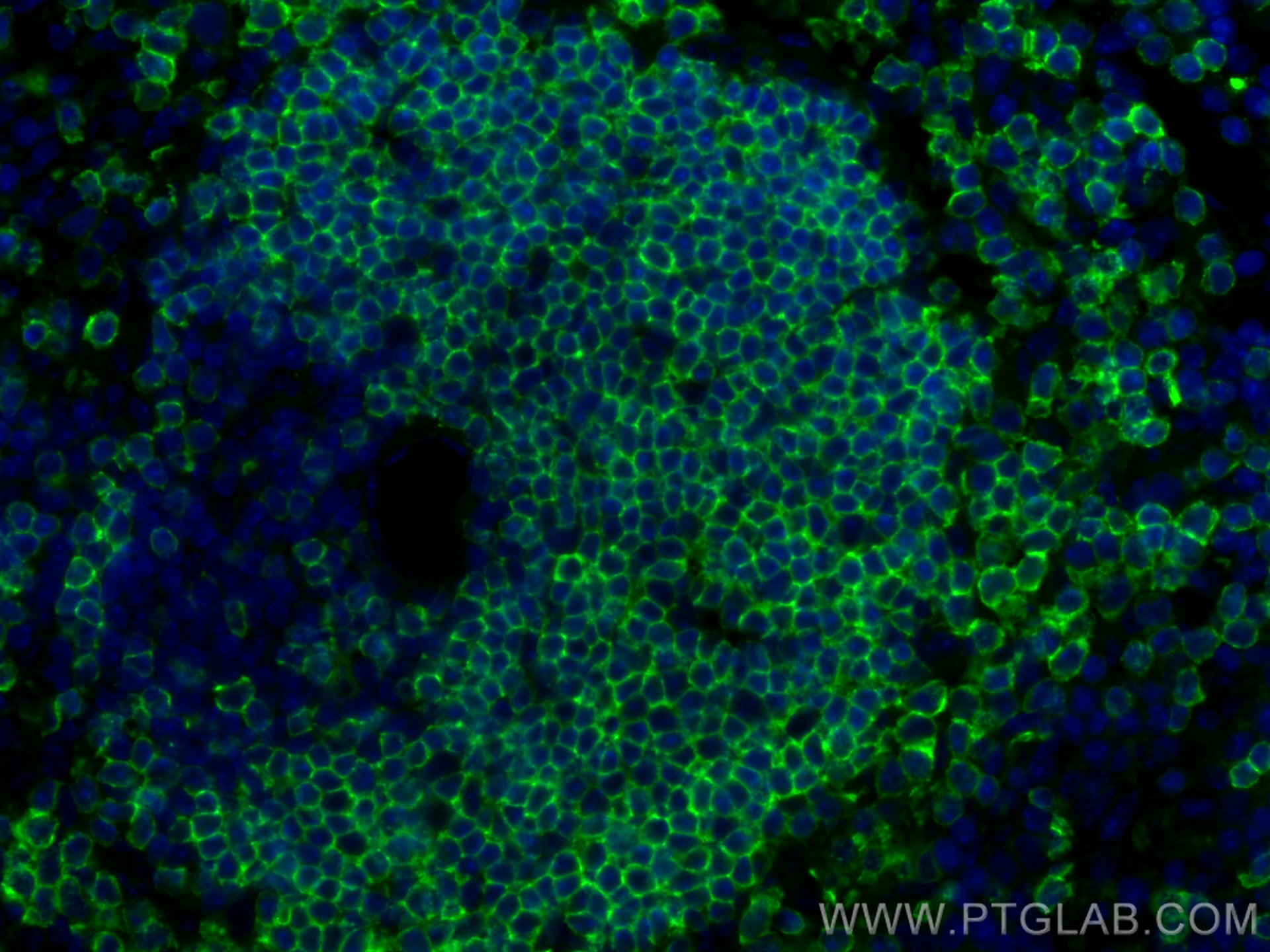 IF Staining of mouse spleen using 65139-1-Ig