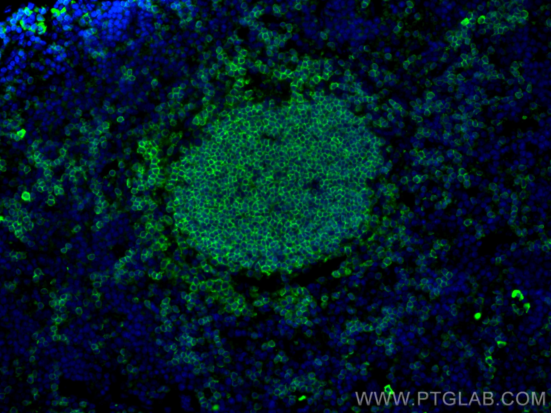 IF Staining of mouse spleen using 65139-1-Ig