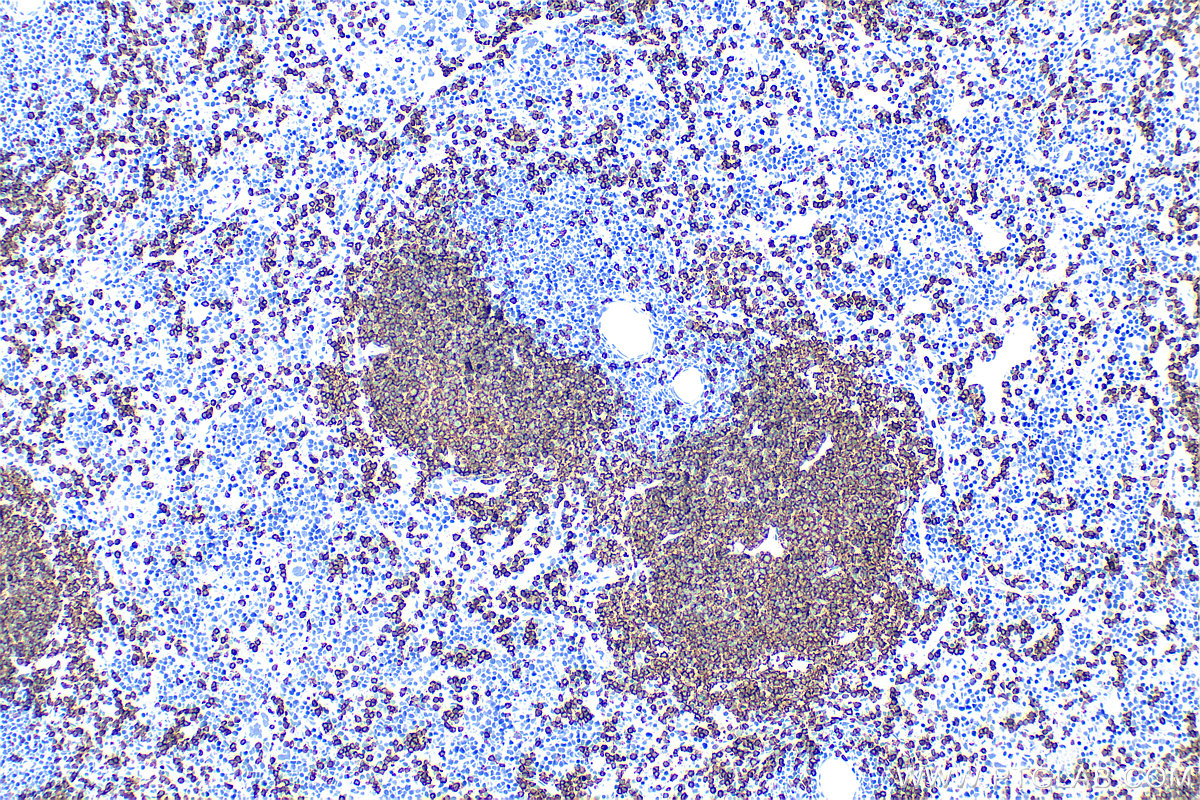 IHC staining of mouse spleen using 65139-1-Ig