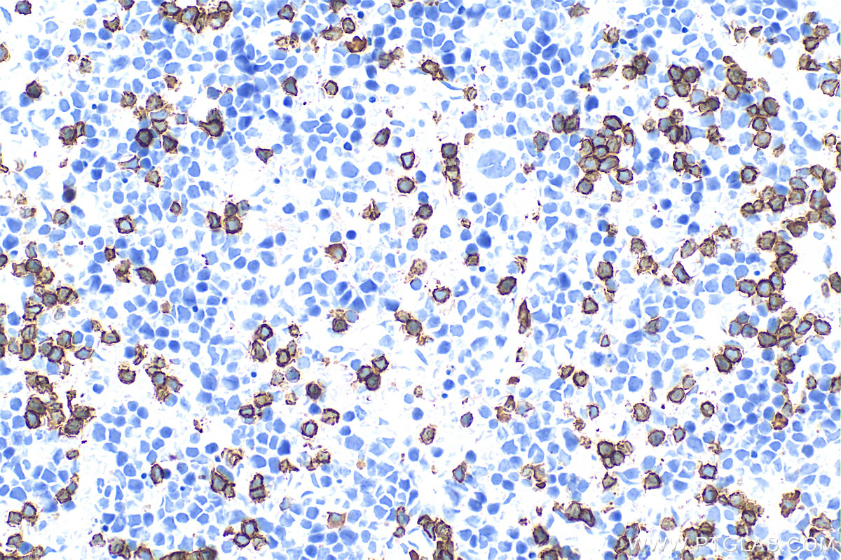 IHC staining of mouse spleen using 65139-1-Ig