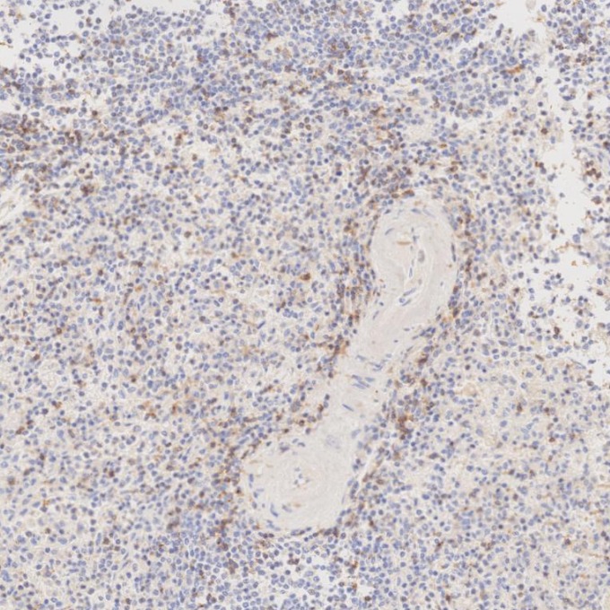 IHC staining of human spleen using 65150-1-Ig IHC staining of human spleen using 65150-1-Ig