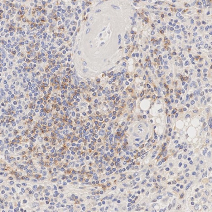 IHC staining of human spleen using 65150-1-Ig IHC staining of human spleen using 65150-1-Ig