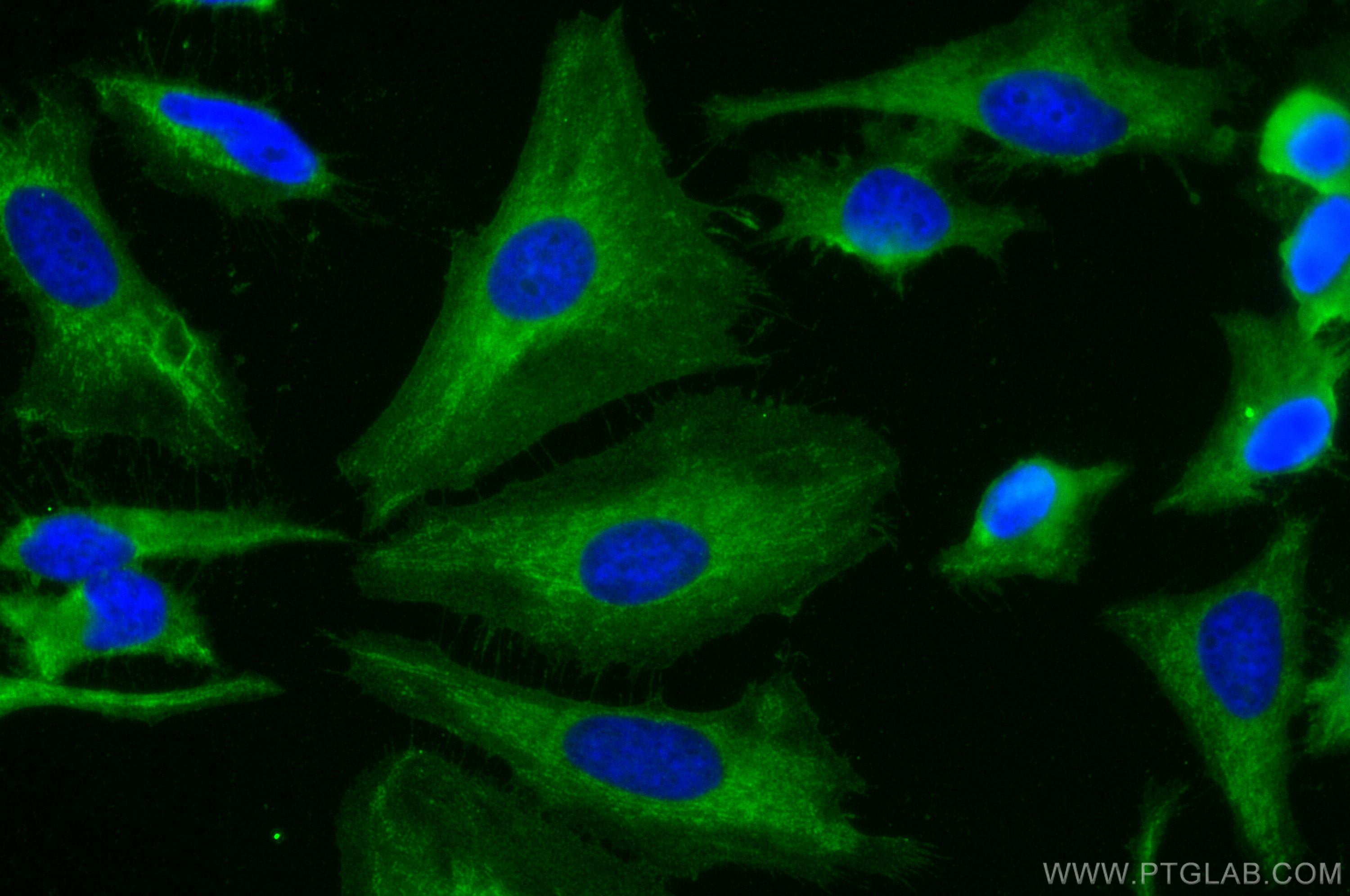 IF Staining of HeLa using 12494-1-AP