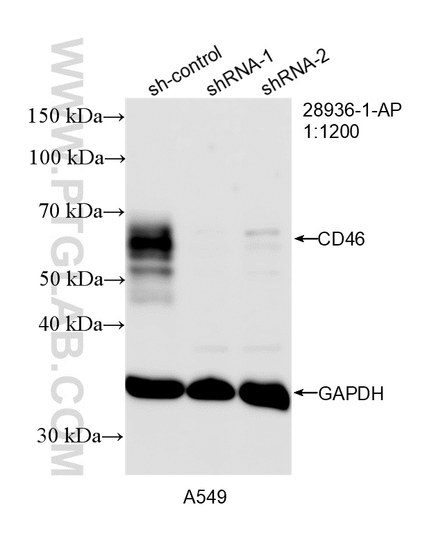 WB analysis of A549 using 28936-1-AP WB analysis of A549 using 28936-1-AP