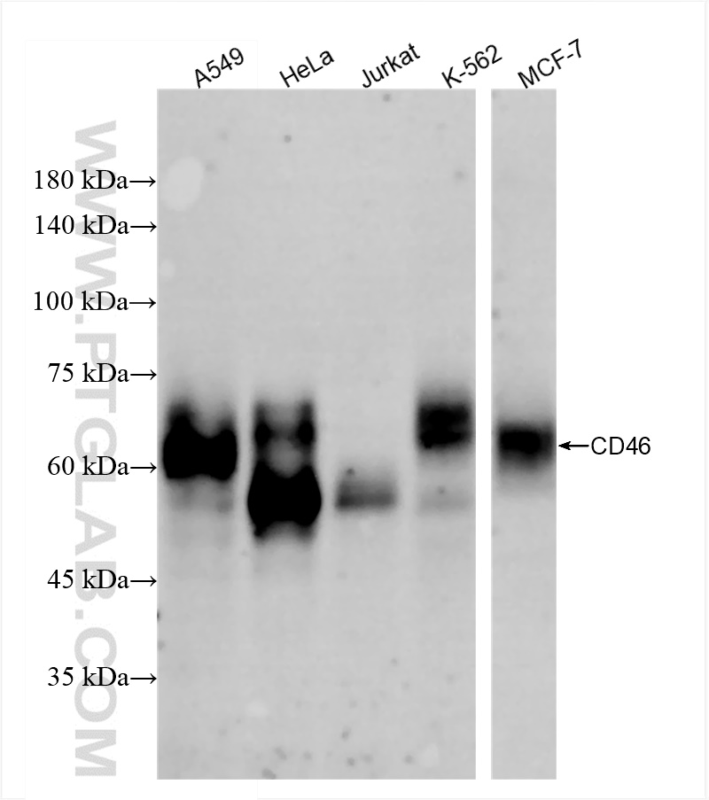 WB analysis using 84599-5-RR