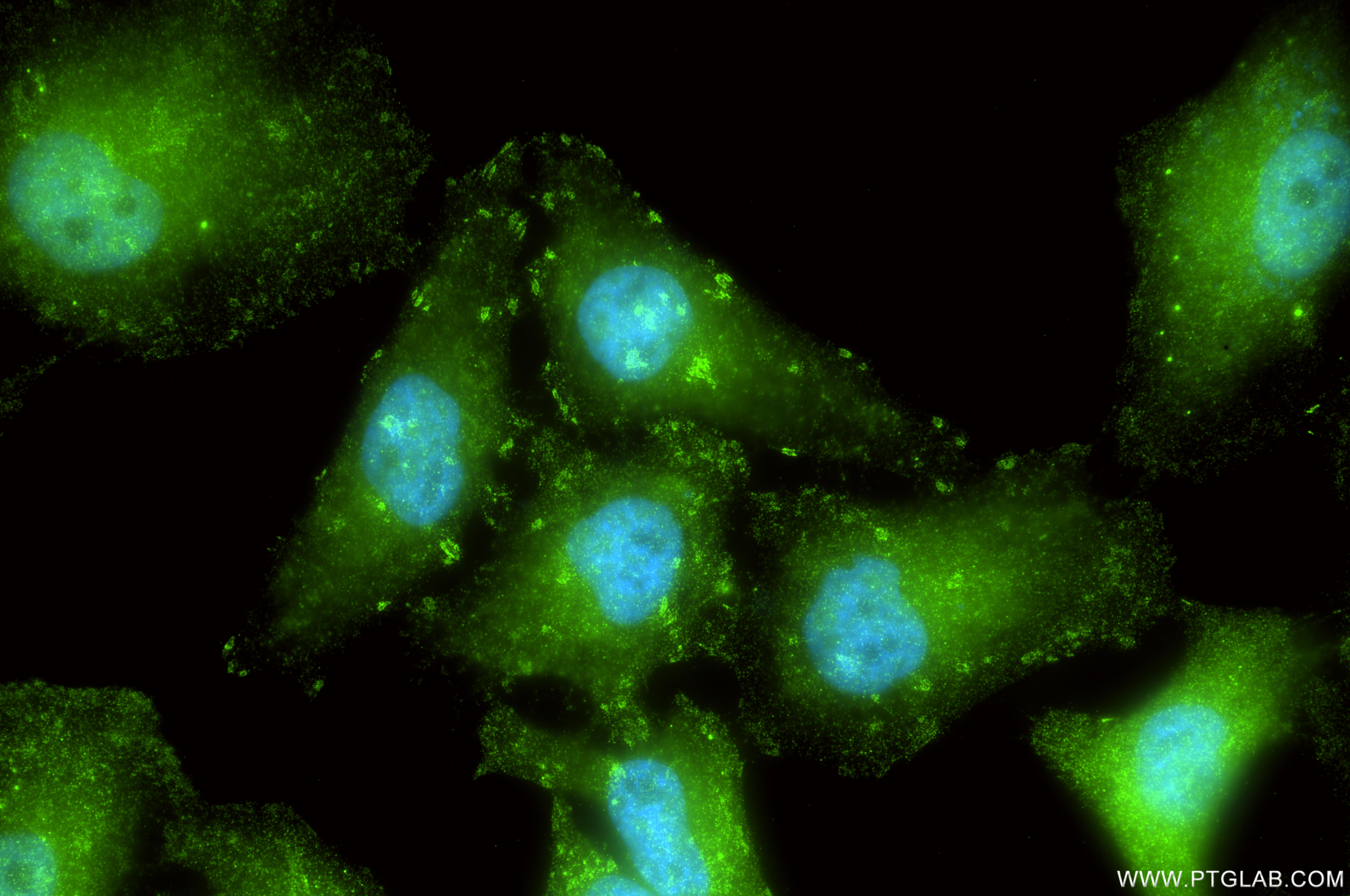 Immunofluorescent analysis of (4% PFA) fixed HeLa cells using CD46 antibody (98240-1-RR, Clone: 241764C9 ) at dilution of 1:500 and CoraLite®488-Conjugated Goat Anti-Rabbit IgG(H+L) (<a class='green' href='/productredirect?CatalogNo=SA00013-2' target='_blank'>SA00013-2</a>). IF Staining of HeLa using 98240-1-RR