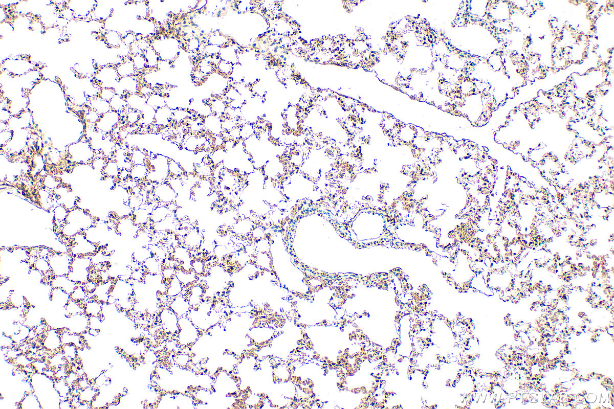IHC staining of mouse lung using 31886-1-AP
