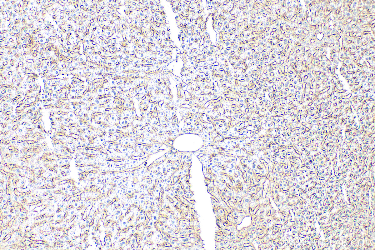IHC staining of mouse liver using 31886-1-AP