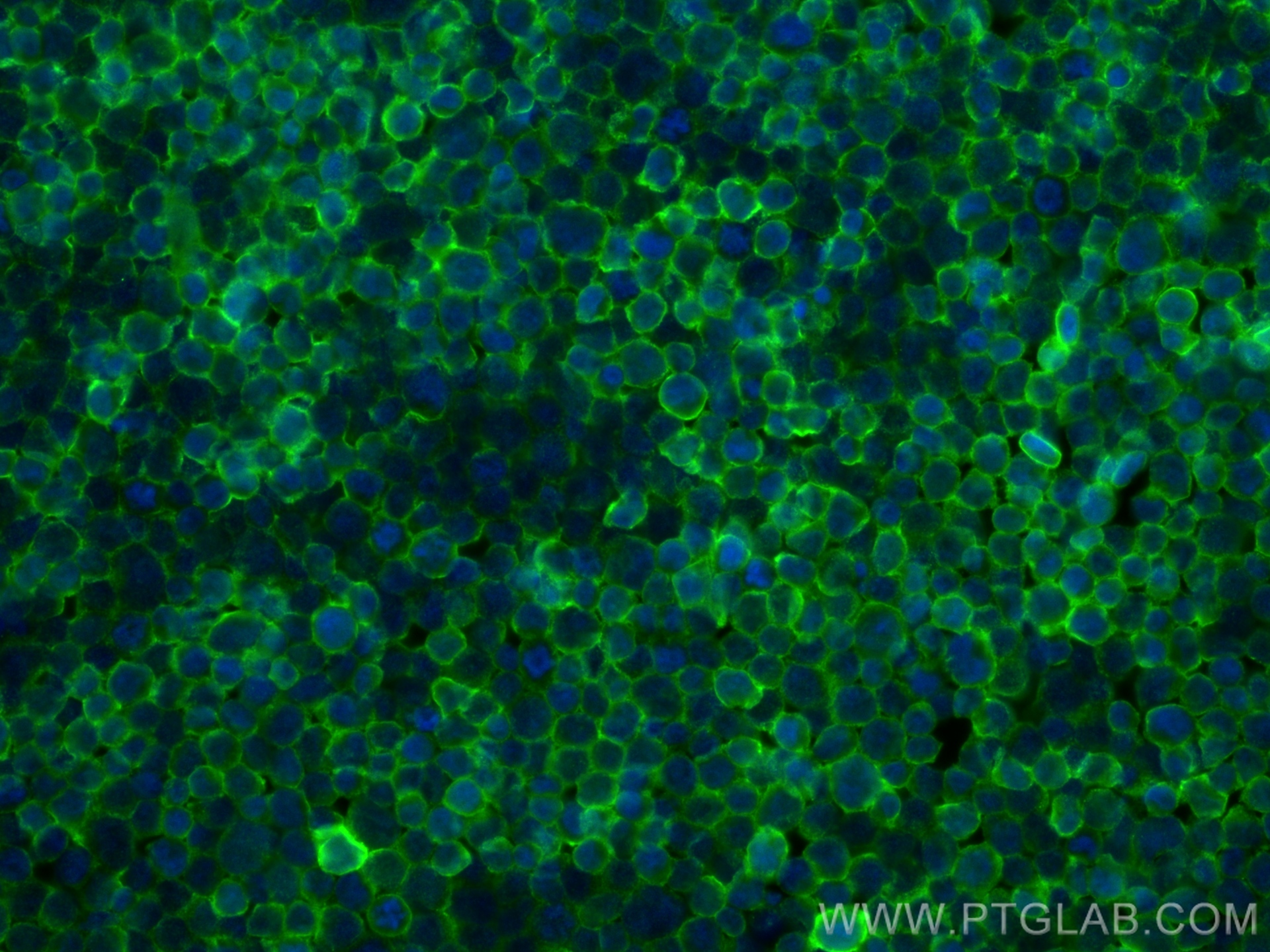 IF Staining of Jurkat using 60551-1-Ig