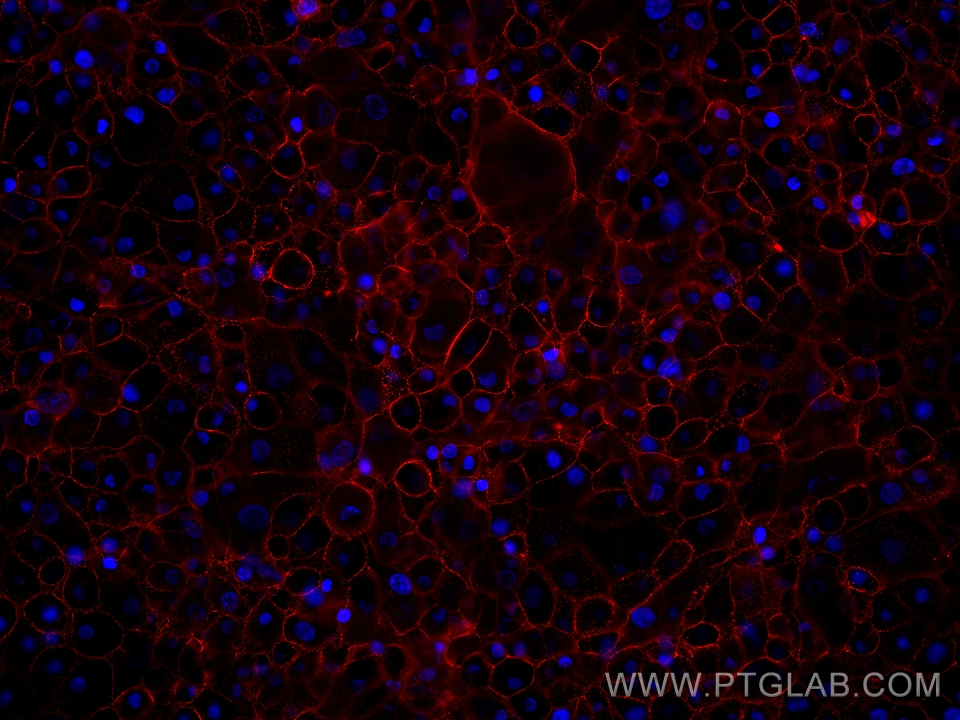 IF Staining of A431 using 60551-1-Ig
