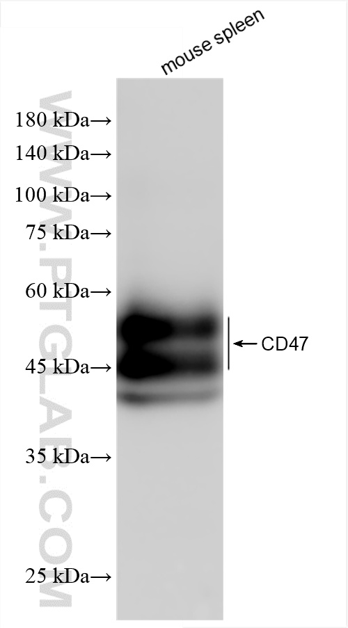 WB analysis of mouse spleen using 85958-1-RR
