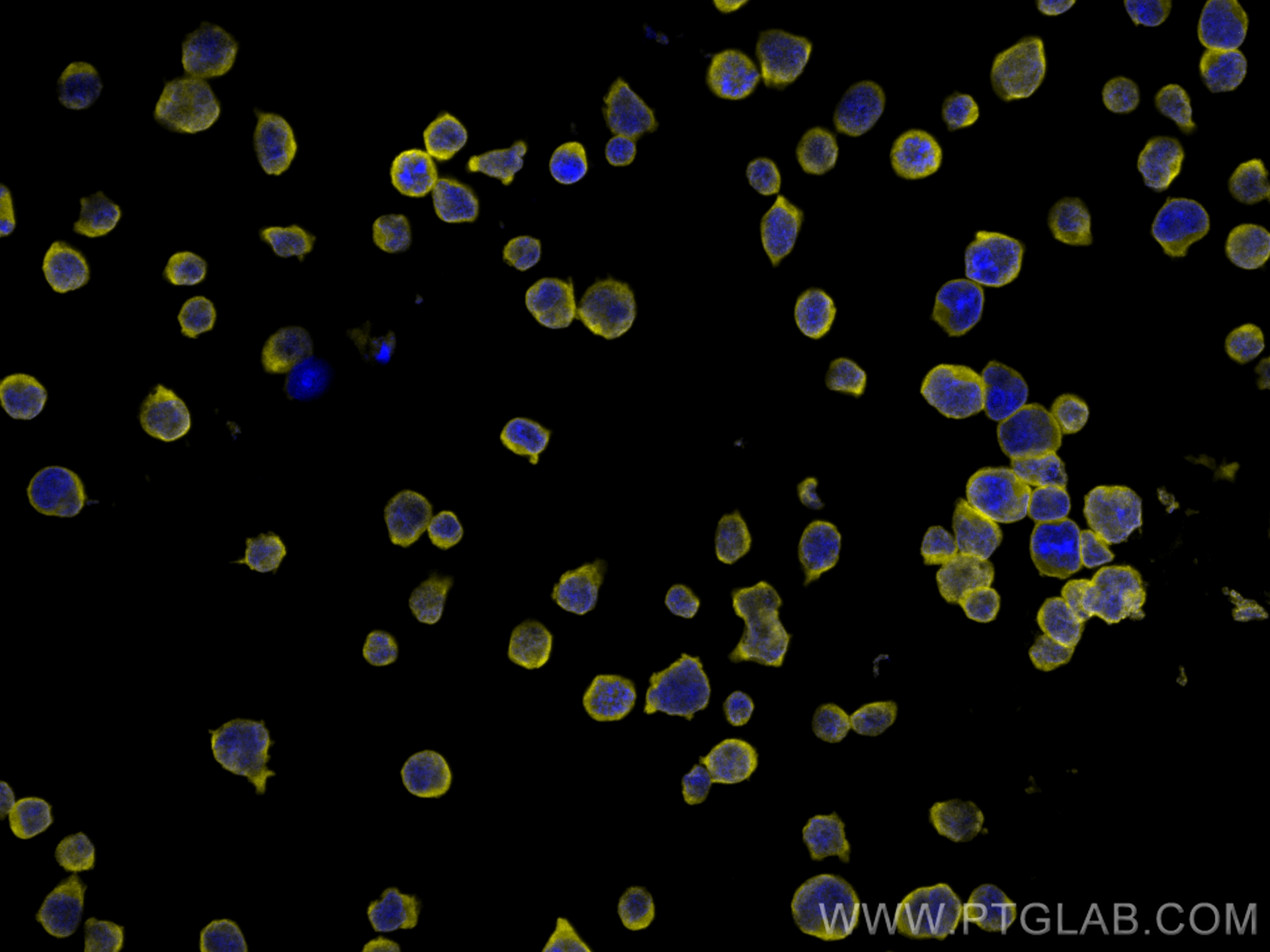 IF Staining of Jurkat using CL532-66304