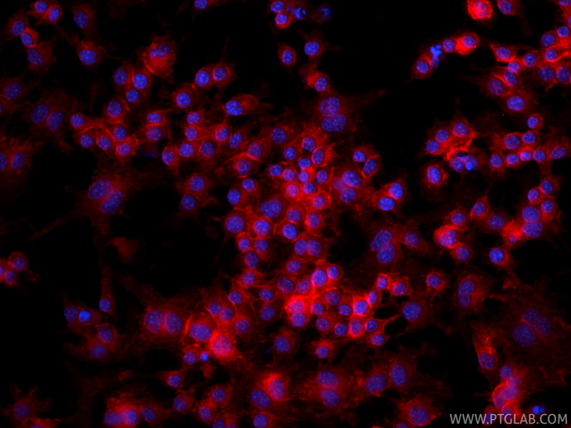 IF Staining of RAW 264.7 using CL594-85958 IF Staining of RAW 264.7 using CL594-85958