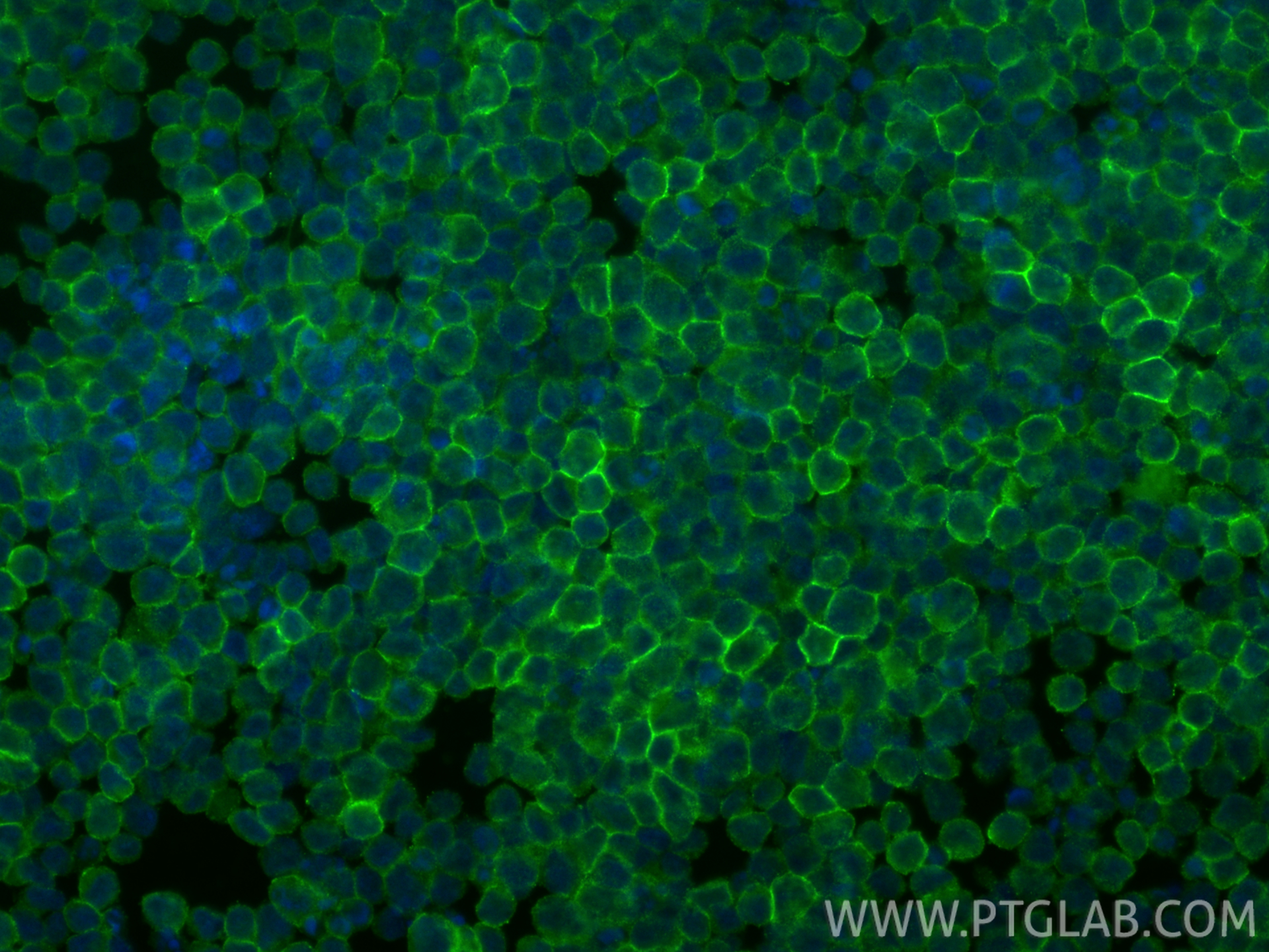 IF Staining of Ramos using 27519-1-AP IF Staining of Ramos using 27519-1-AP