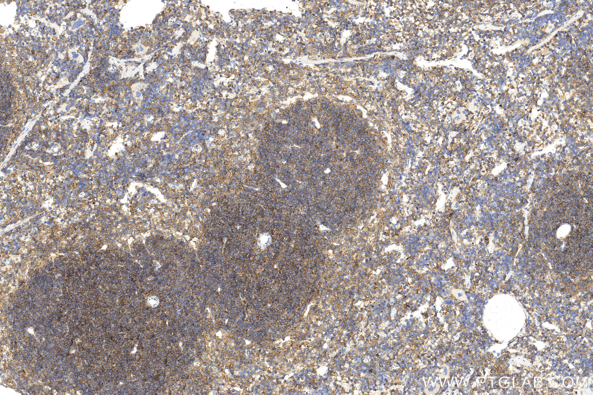 IHC staining of mouse spleen using 31774-1-AP