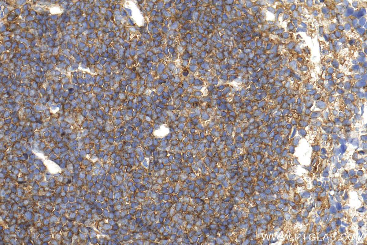 IHC staining of mouse spleen using 31774-1-AP