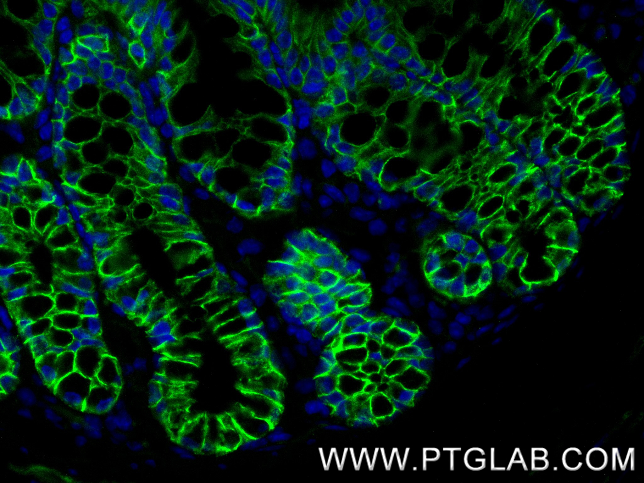 IF Staining of mouse colon using 87503-1-RR