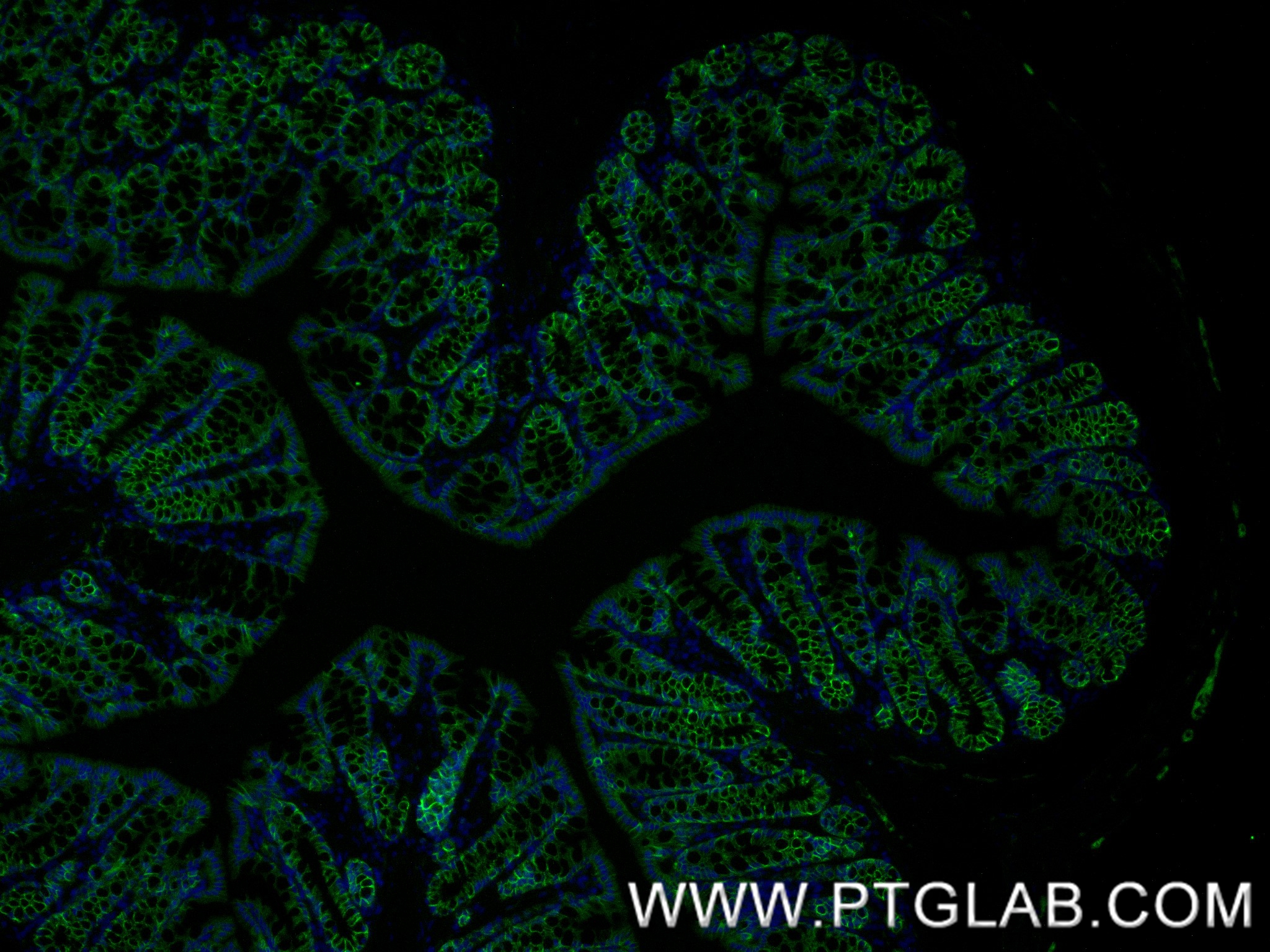 IF Staining of mouse colon using 87503-1-RR