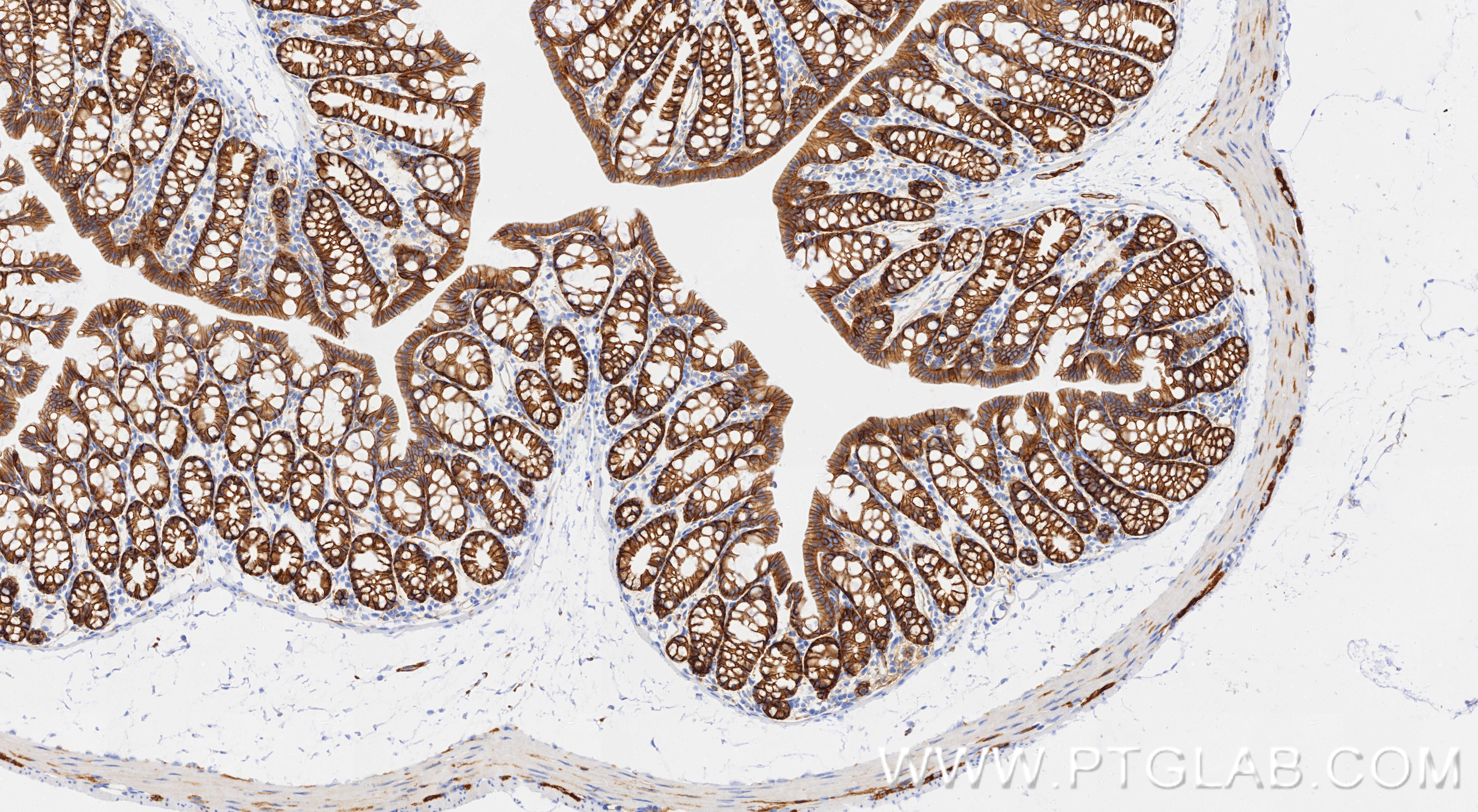 IHC staining of mouse colon using 87503-1-RR IHC staining of mouse colon using 87503-1-RR