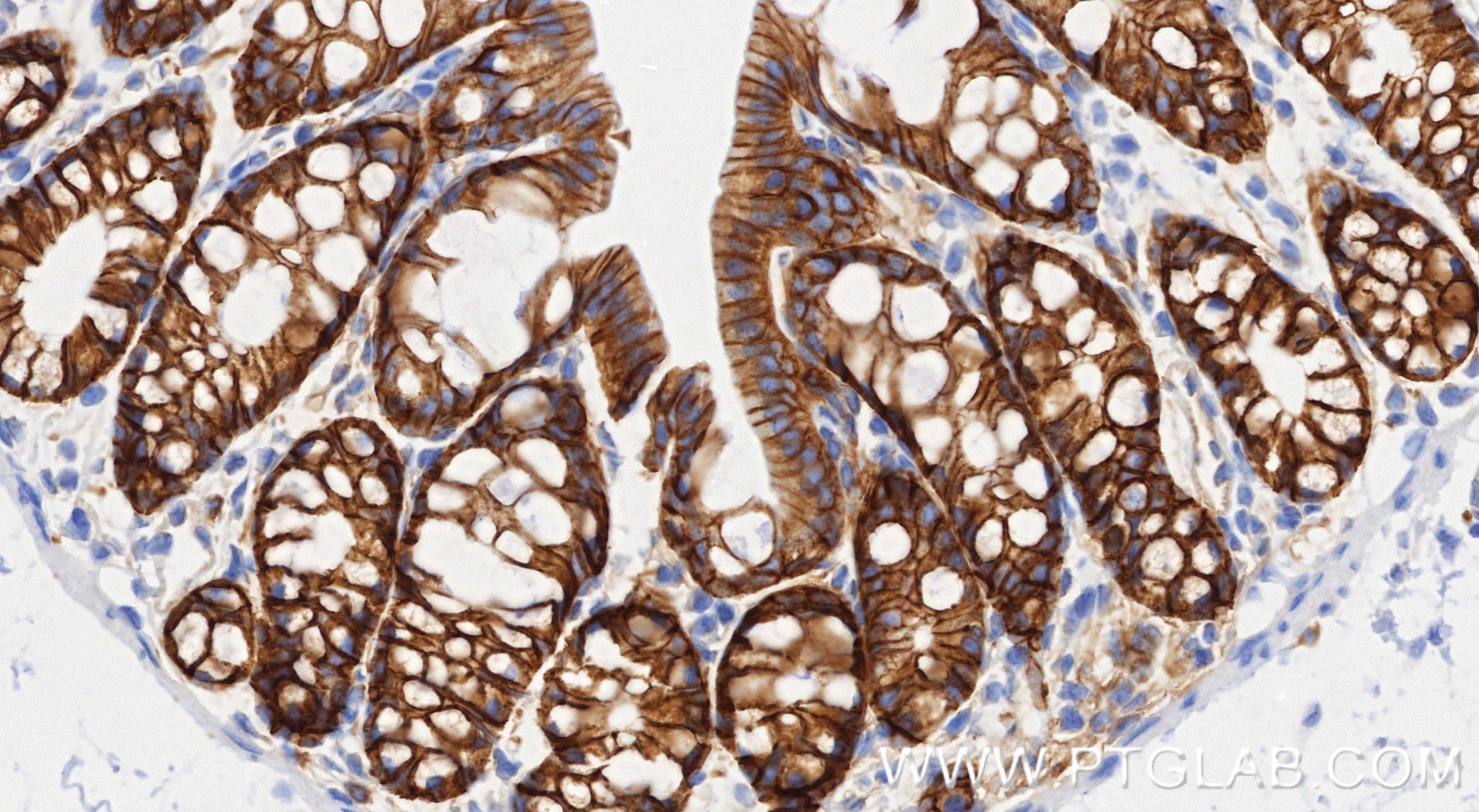 IHC staining of mouse colon using 87503-1-RR IHC staining of mouse colon using 87503-1-RR