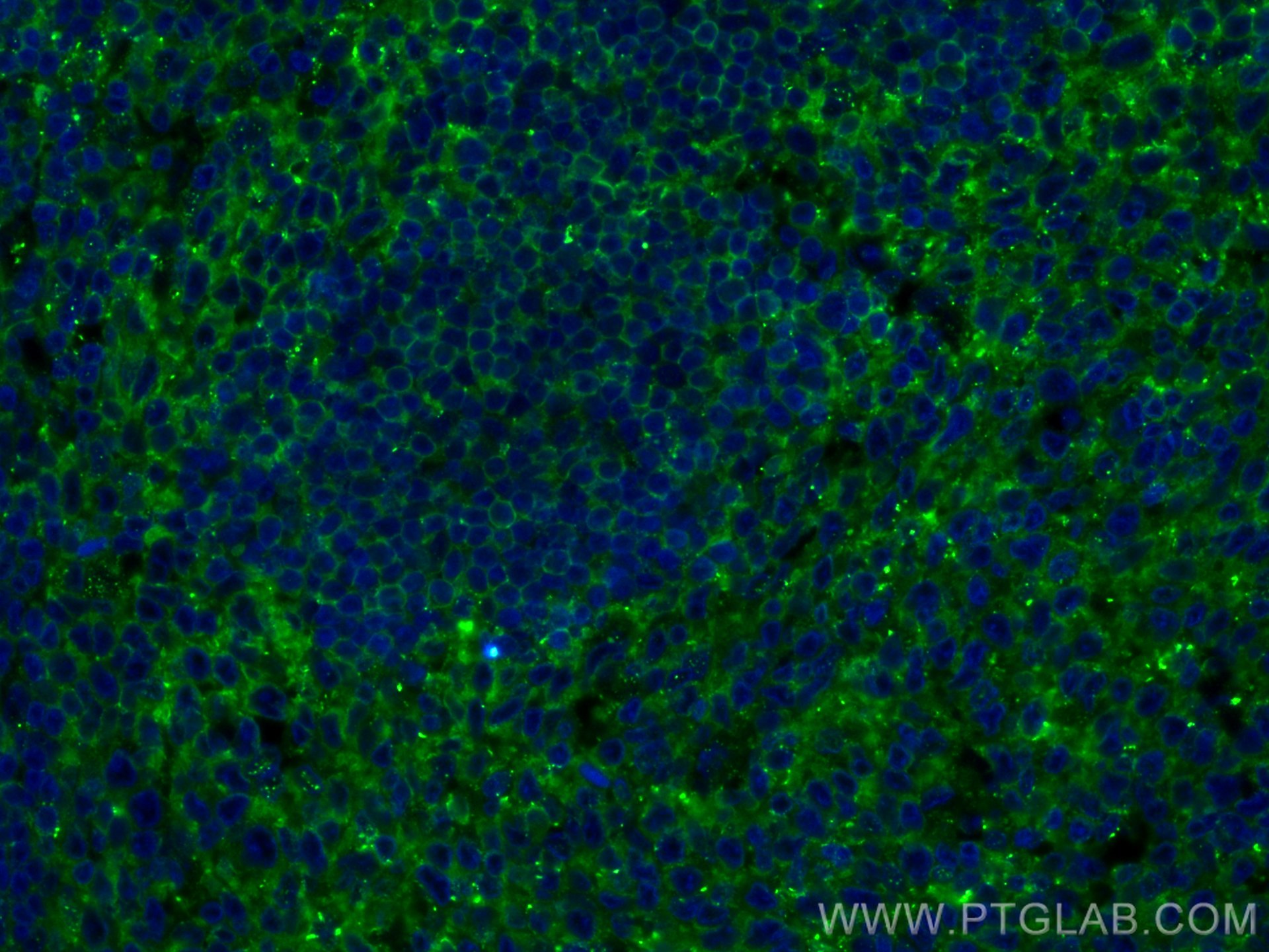 IF Staining of human tonsillitis using 17227-1-AP