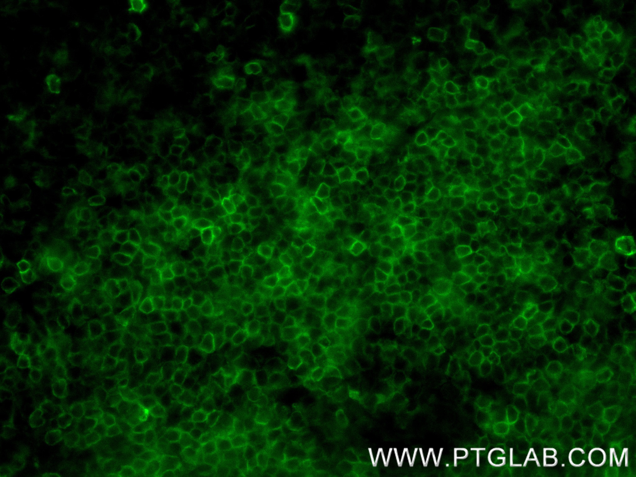 IF Staining of mouse spleen using 83451-4-RR