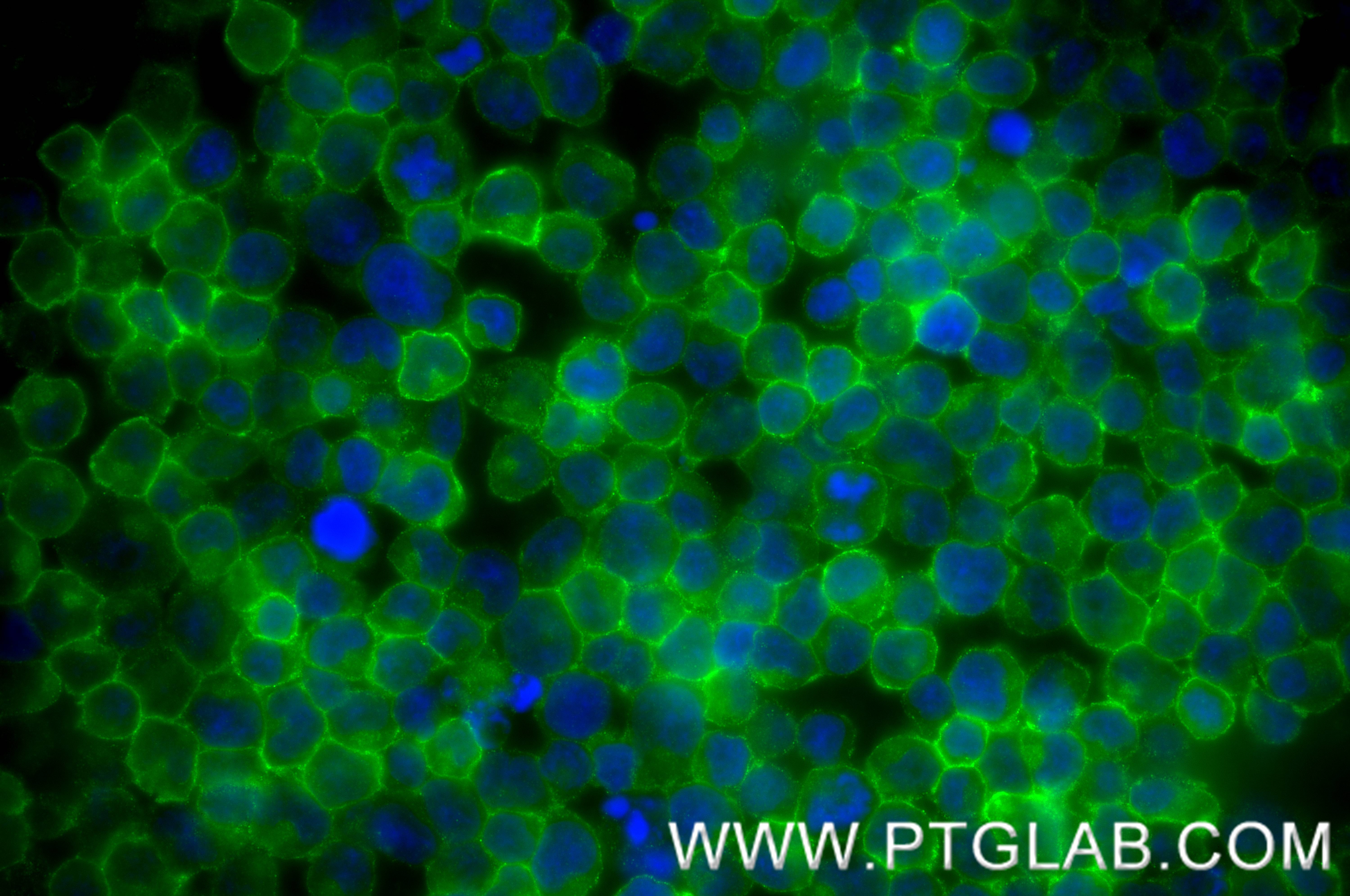 Immunofluorescent analysis of (4% PFA) fixed Jurkat cells using CD5 antibody (83543-7-RR, Clone: 240428G2 ) at dilution of 1:500 and Multi-rAb CoraLite ® Plus 488-Goat Anti-Rabbit Recombinant Secondary Antibody (H+L) (RGAR002). IF Staining of Jurkat using 83543-7-RR