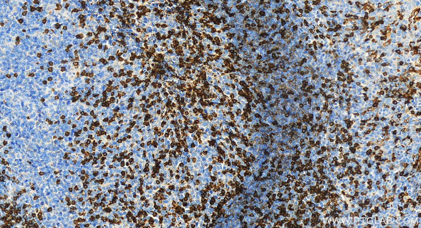 IHC staining of human tonsillitis using 83543-7-RR (same clone as 83543-7-PBS)