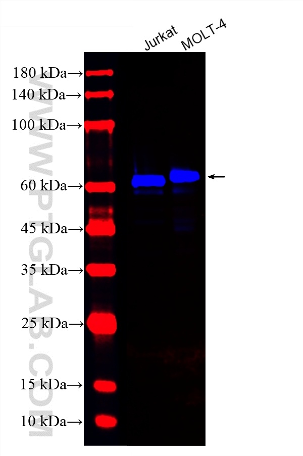 Various lysates were subjected to SDS PAGE followed by western blot with CL750-83543-7 (CD5 antibody) at dilution of 1:500 incubated at room temperature for 1.5 hours. WB analysis using CL750-83543-7
